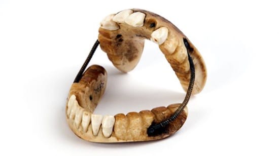 Dentadura postiza de hace un par de siglos